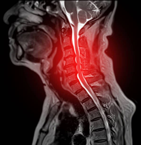 Spine panel discussion.